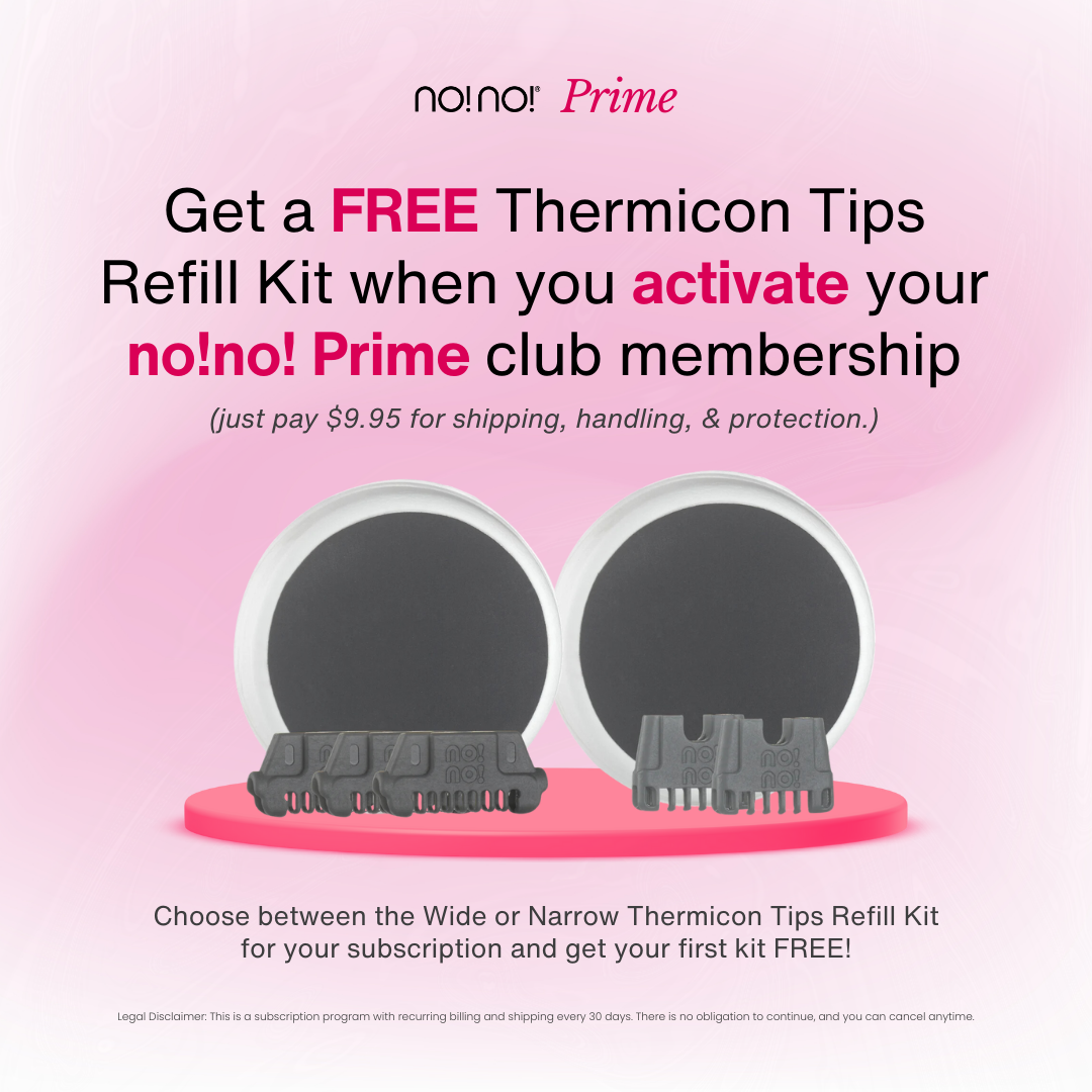 no!no! Prime Club Activation | FREE